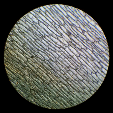 Onion Cell Observation