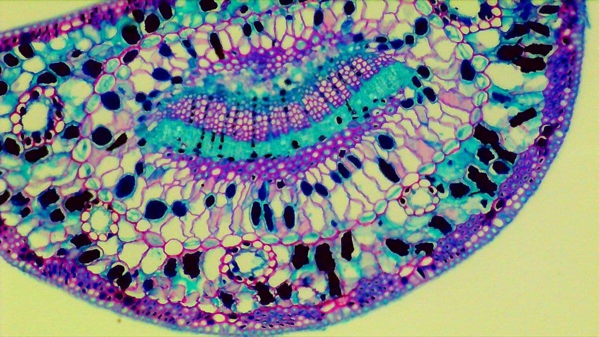 Magnified microscopic view displayed on the MX2-AS screen